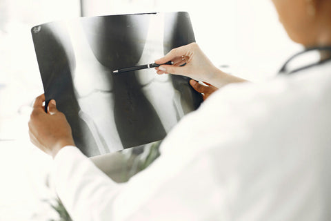 Reprogramación celular para artrosis de rodilla: qué es, en qué punto está y qué significa en 2026