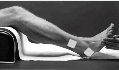 Colocación de los TENS para la incontinencia urinaria